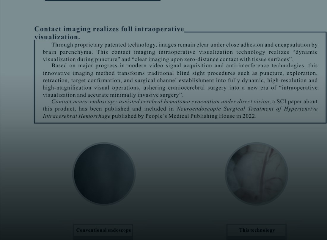 Brochure — NeuroClear zero-distance contact imaging